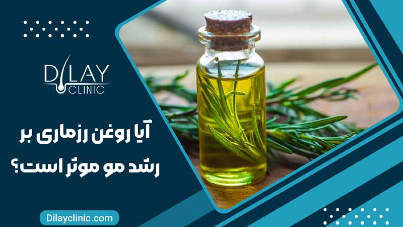 آیا روغن رزماری بر رشد مو موثر است؟