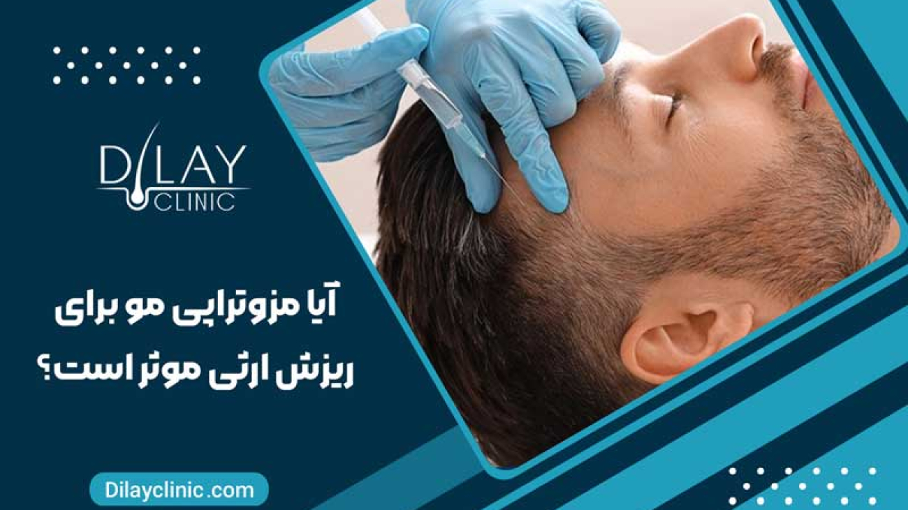 آیا مزوتراپی مو برای ریزش ارثی موثر است؟