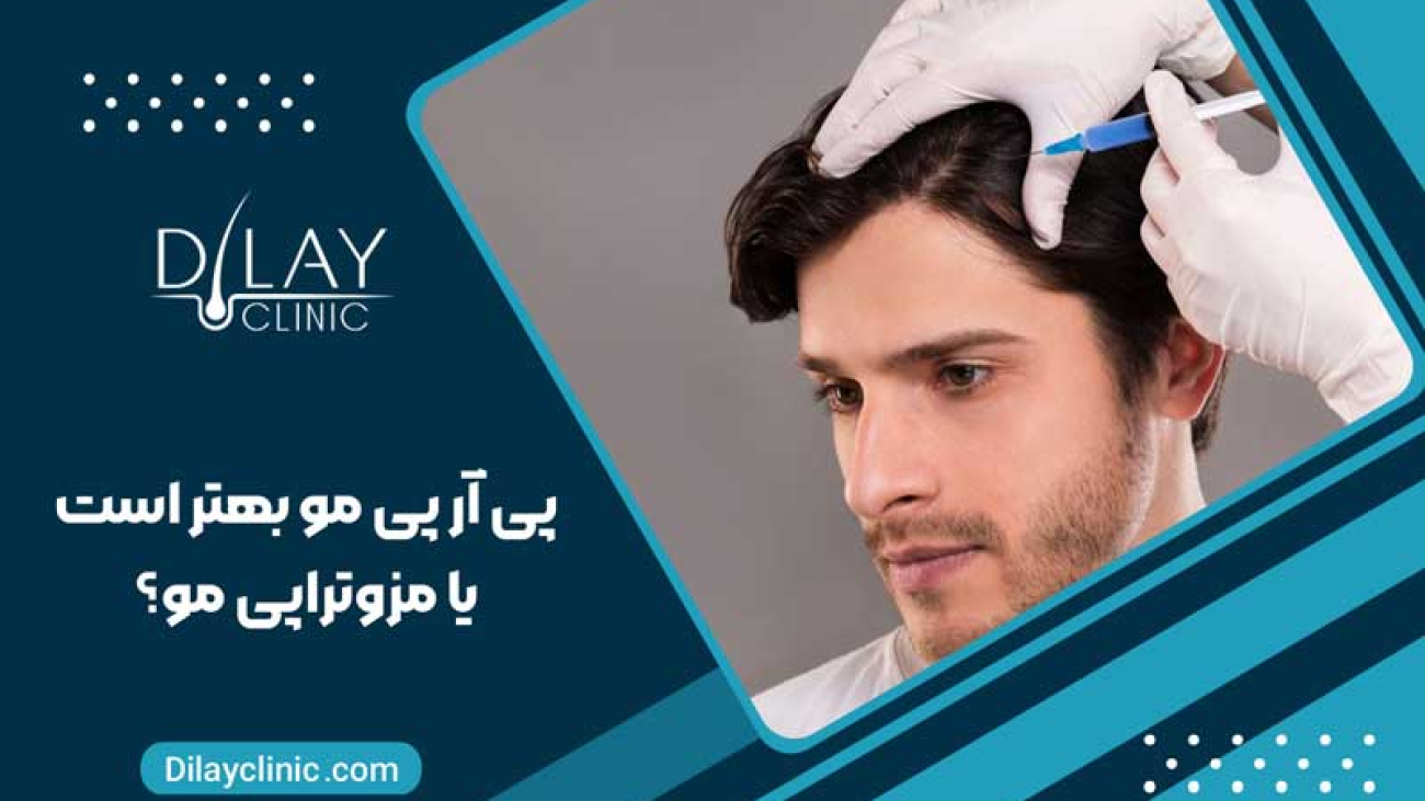 پی آر پی مو بهتر است یا مزوتراپی مو؟ | مقایسه PRP و مزوتراپی