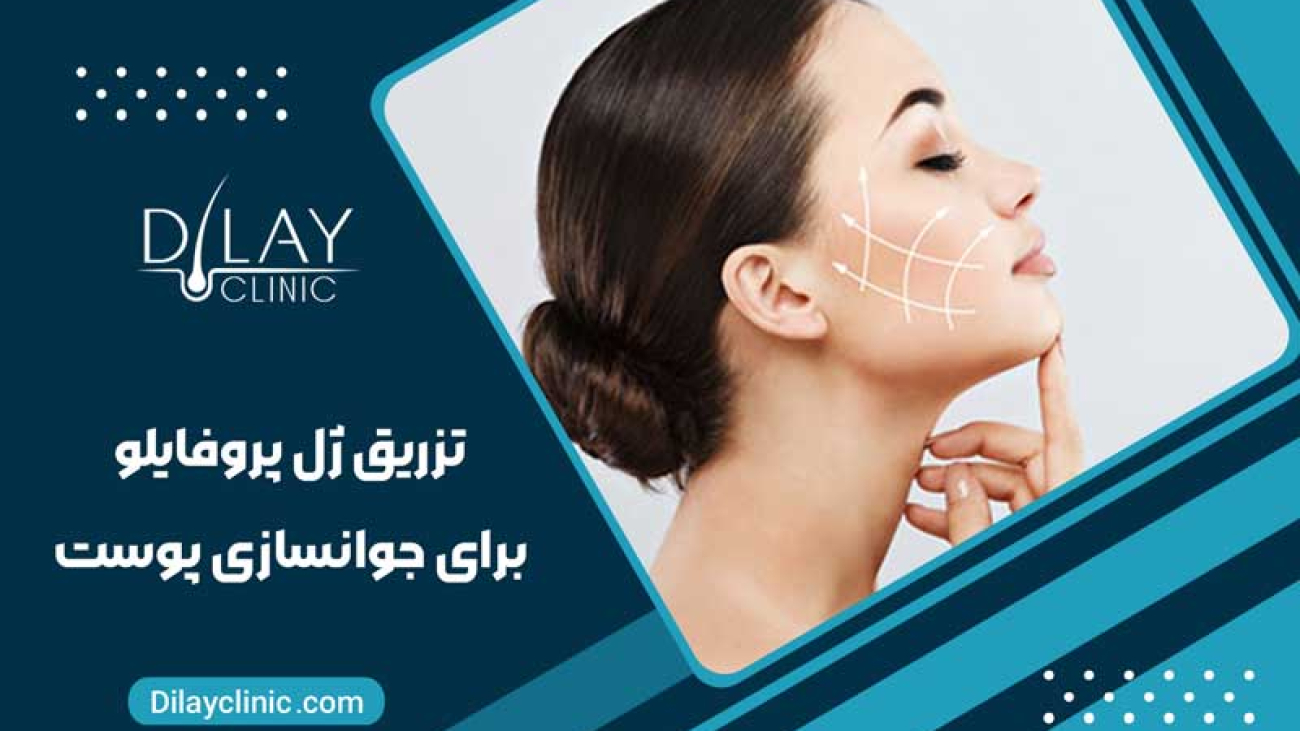 تزریق ژل پروفایلو برای جوانسازی پوست